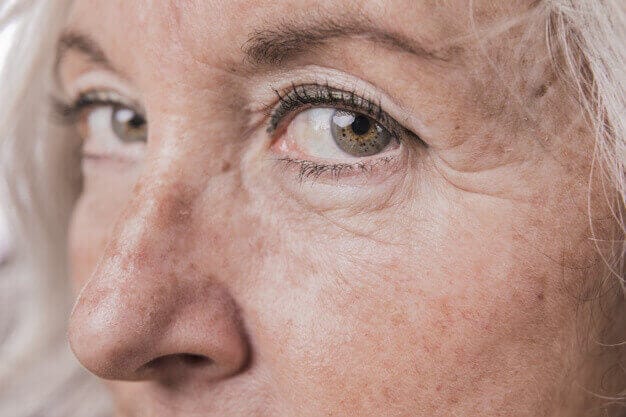Doença de Alzheimer: sintomas, fases e como agir no dia a dia